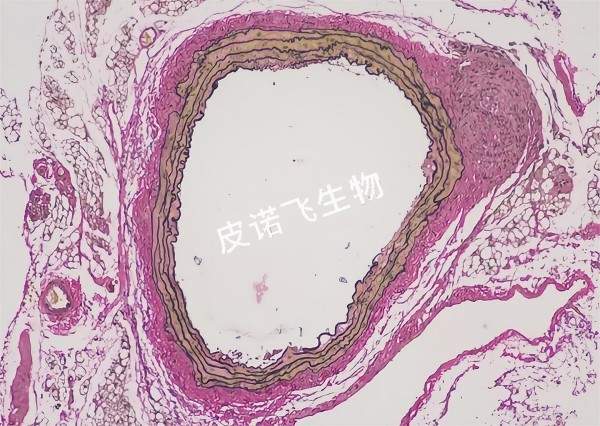 EVG 血管