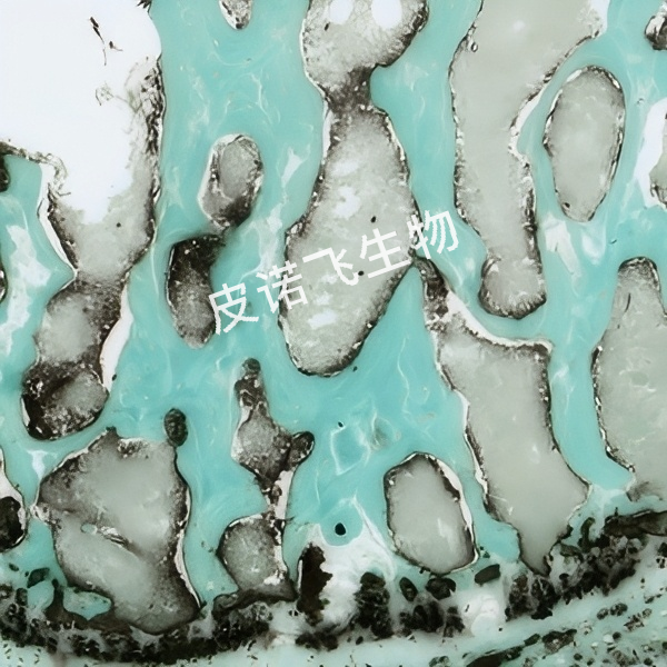 ALP+快绿 椎骨