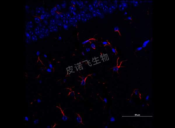 脑 GFAP红 600-1_RGB