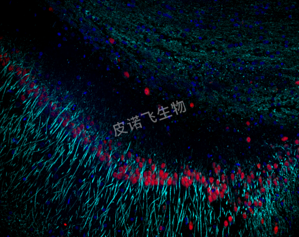 β-Tubulin 青； Neun 红