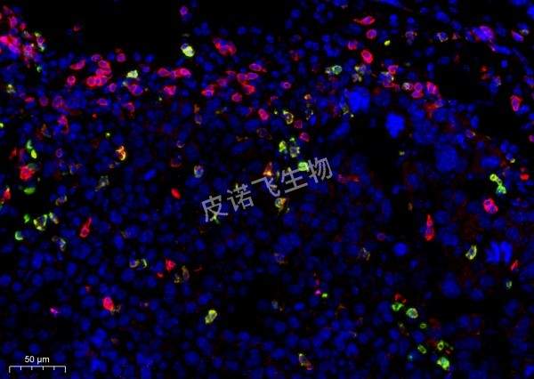 CD8绿+CD4红 肝