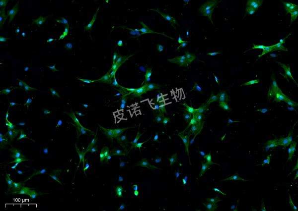 CTNT绿_ 细胞爬片