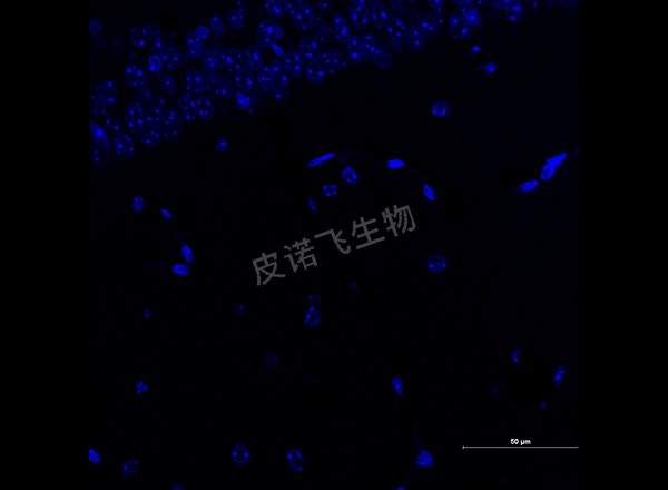脑 GFAP红 600-1_RGB_DAPI