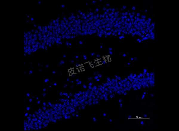 脑 neun红+iba-1绿 400-1_RGB_DAPI