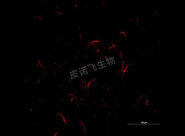 脑 GFAP红 600-1_RGB_CY3