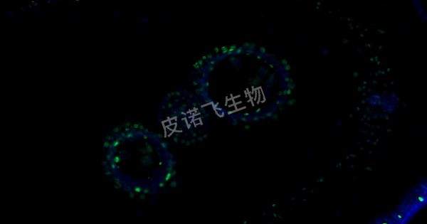 植物花药 tunel绿