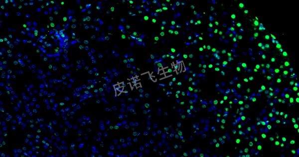 肾 tunel绿