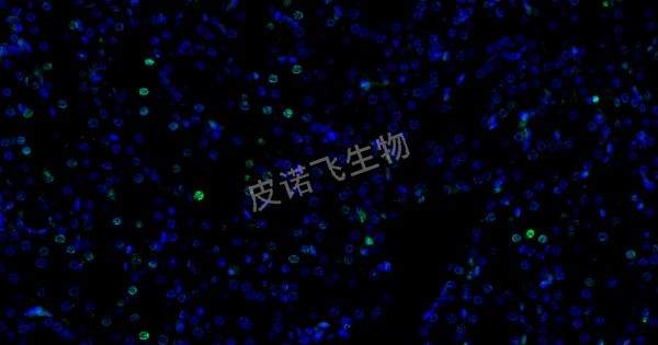 肝 tunel 绿