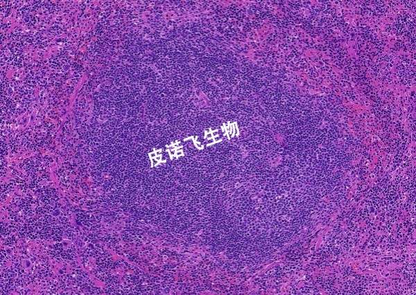 脾HE