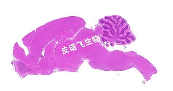 矢状脑_HE