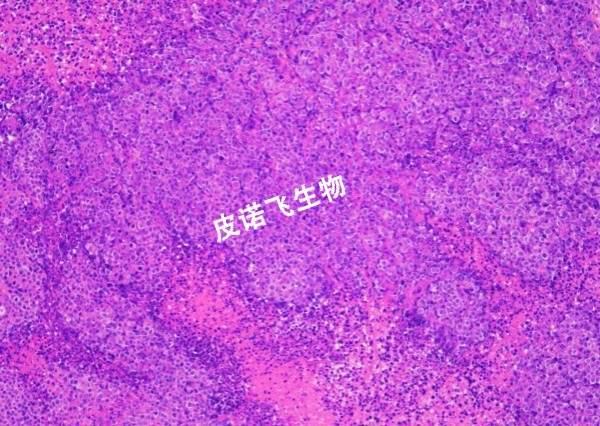 肿瘤HE