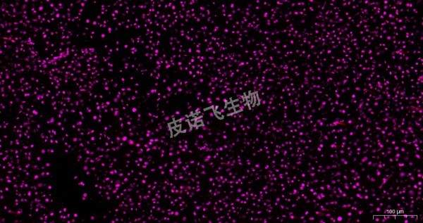 肿瘤 ros