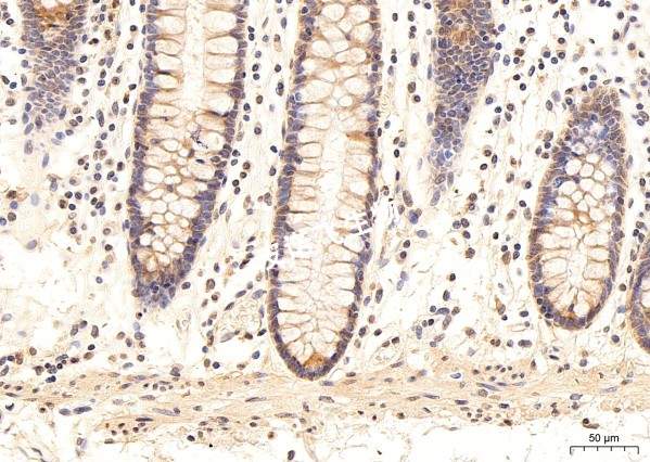 mRNA  DAB显色 胃_40.0x