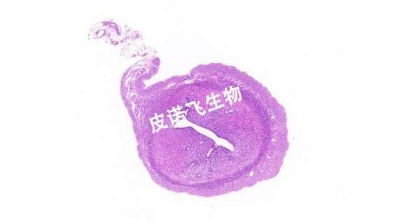 子宫_HE