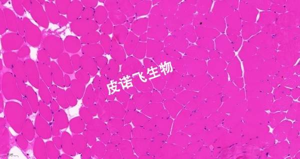 肌肉HE