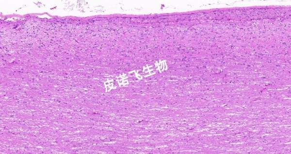 脊髓纵_HE
