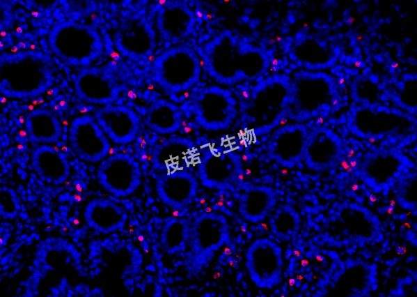 CD163探针 肠_40.0x