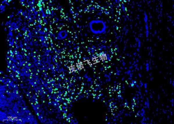 mRNA 绿 癌20.0x