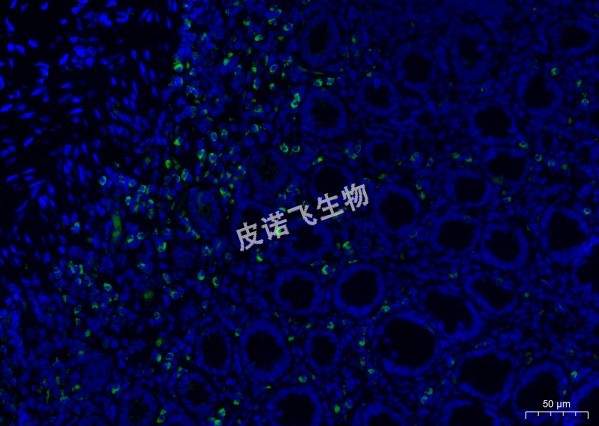 miRNA绿 肠_40.0x