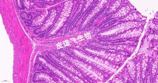 结肠HE