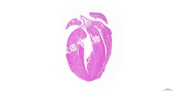 四腔心-HE