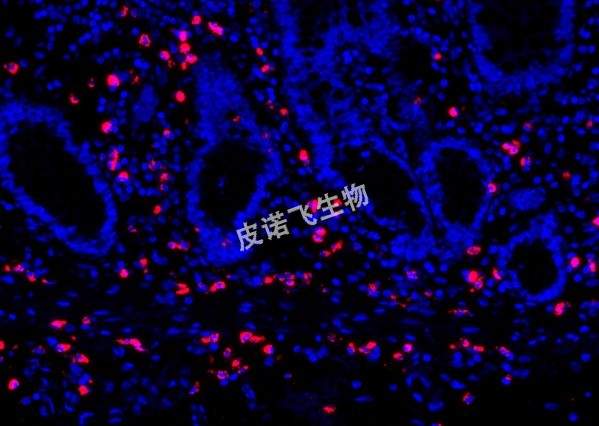 JPX红_肠 40.0x