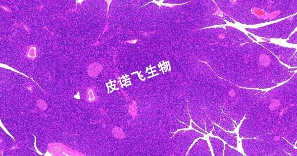 胰_HE