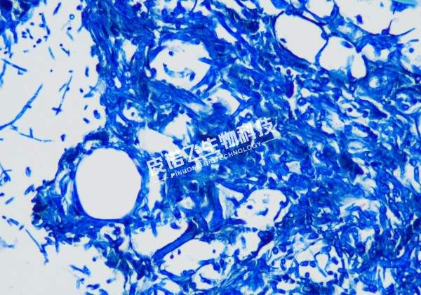 苯胺蓝（白光）染色