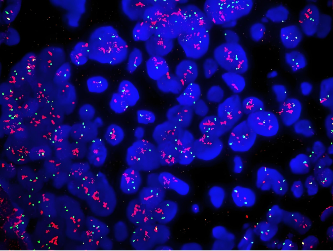 病理原位杂交检测：精准探究疾病背后的真相
