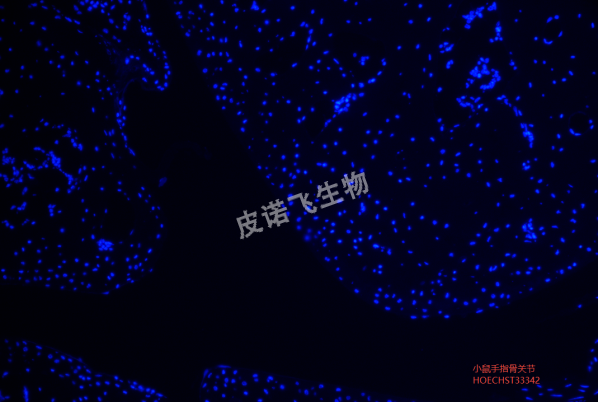 小鼠手指骨关节HOECHST33342.png