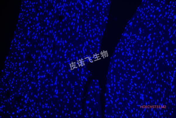 心脏HOECHST33342.png