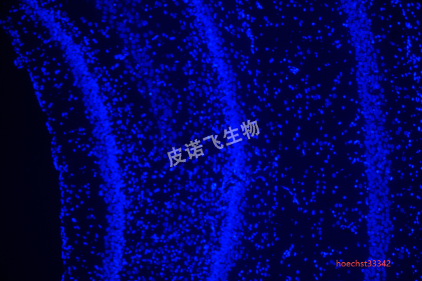 脑hoechst33342.png
